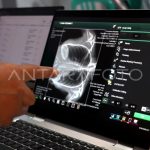 Tangan menunjuk hasil rontgen dada di layar laptop saat pemeriksaan kesehatan
