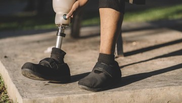 Kaki Palsu Ditanggung BPJS Kesehatan hingga Rp2,75 Juta, Ini Syarat dan 7 Langkahnya