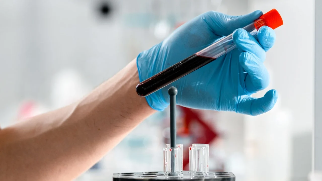 doctor examination blood test laboratory