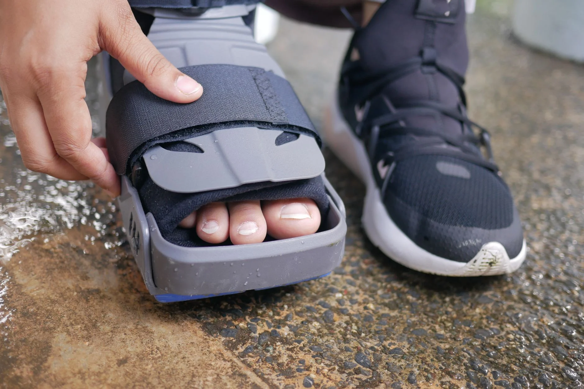 swollen foot joint pain